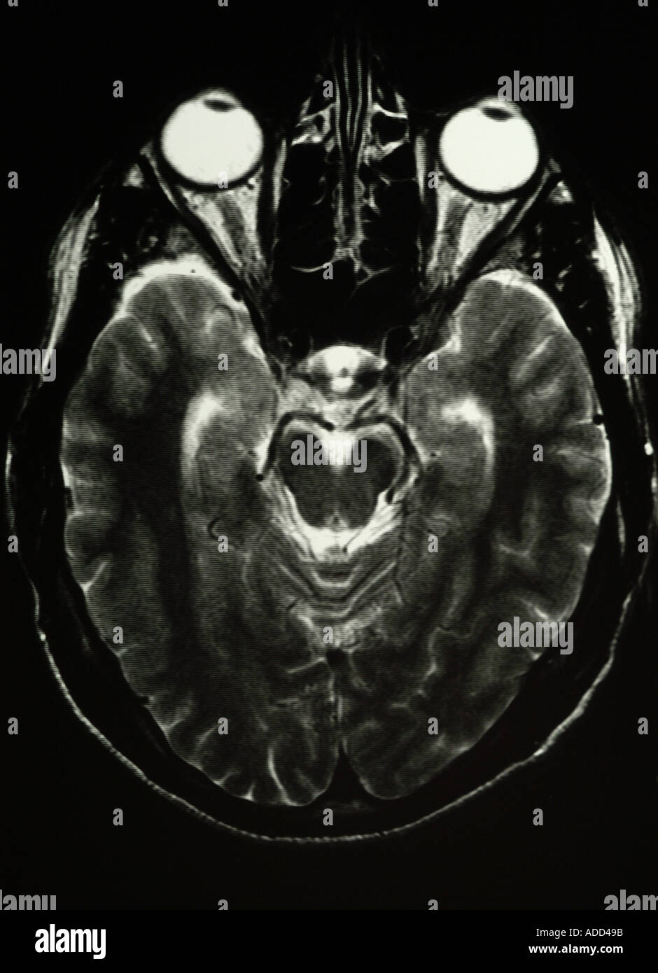 scan of human brain Stock Photo - Alamy