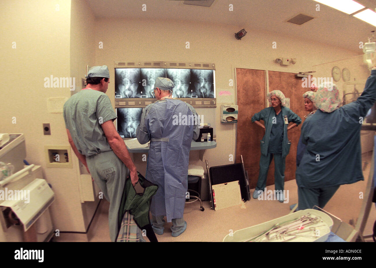 Surgical team reviews x rays in operating room before kidney transplant ...