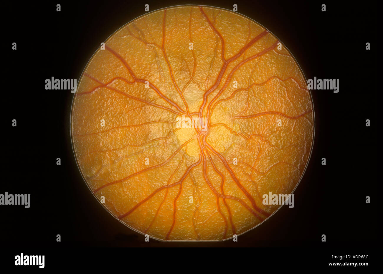 Conceptual view of the Retina and Optic Disc Stock Photo Alamy