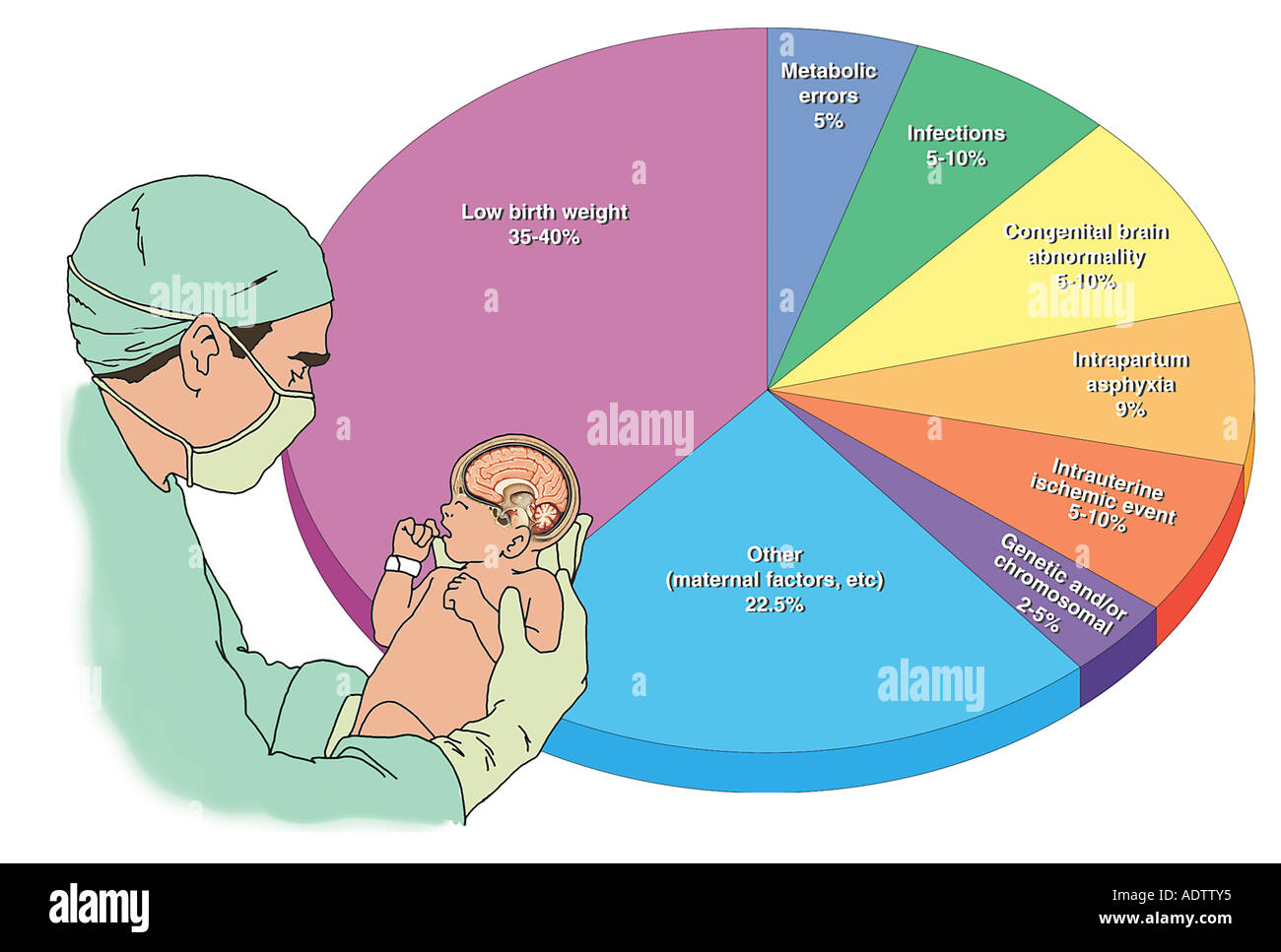 Identified Causes of Cerebral Palsy in the Newborn