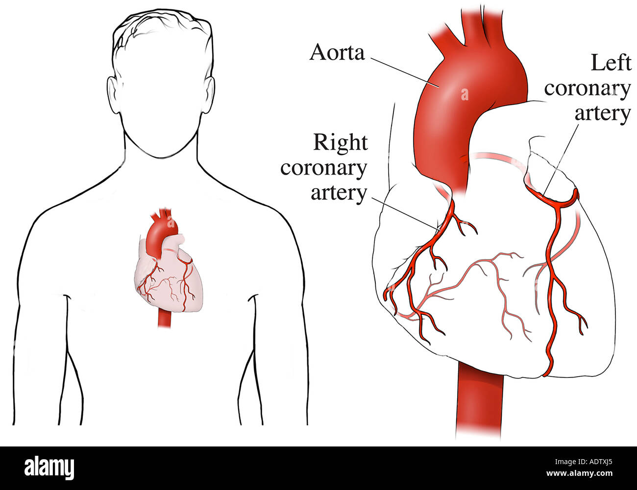 Коронарные артерии где находятся у человека фото