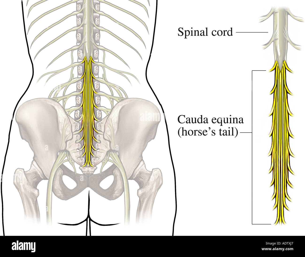 После операции на крестцовый отдел позвоночника. Пояснично-крестцовый отдел спинного мозга. Седалищный нерв и конский хвост. Конский хвост кауда эквина. Спинной мозг конский хвост седалищный нерв.