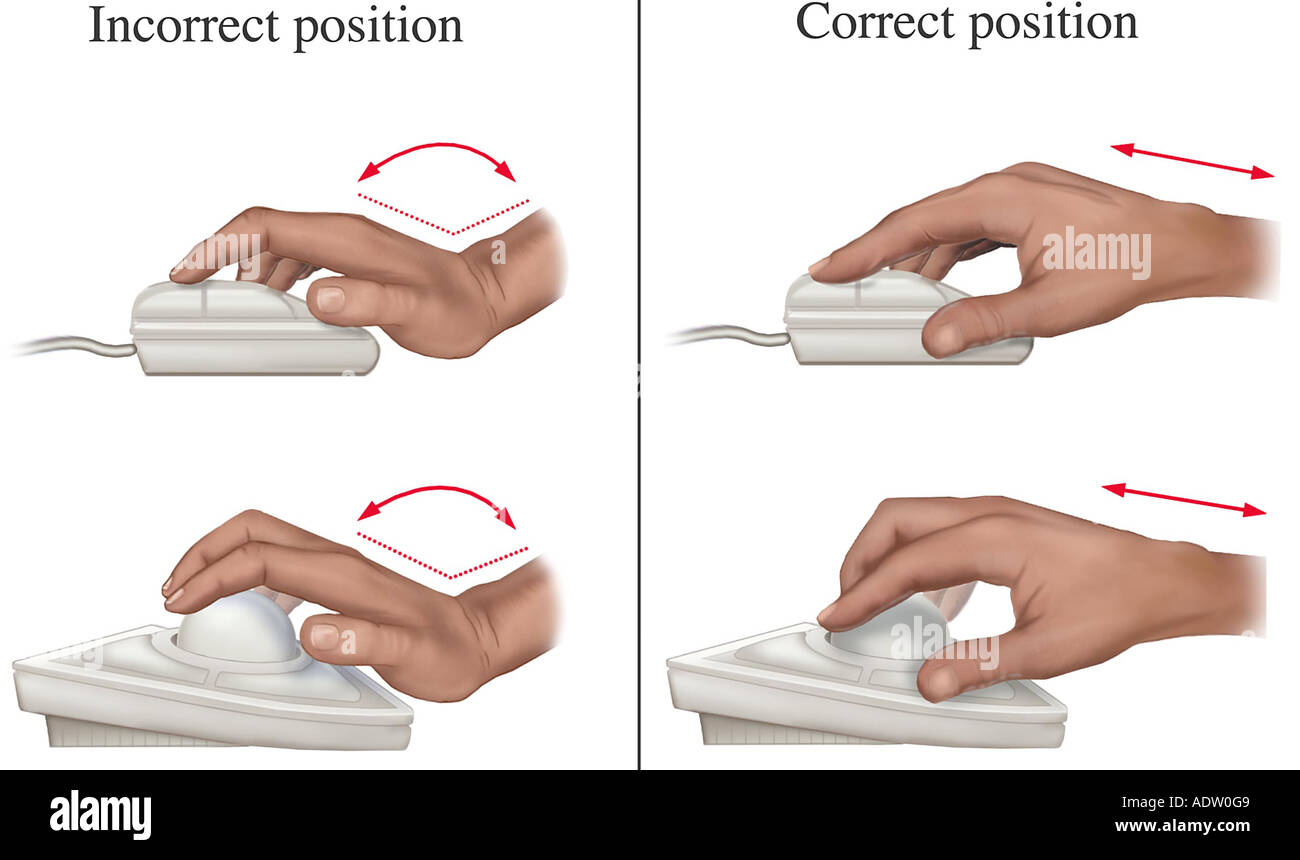 Carpal Tunnel: hand positions Stock Photo