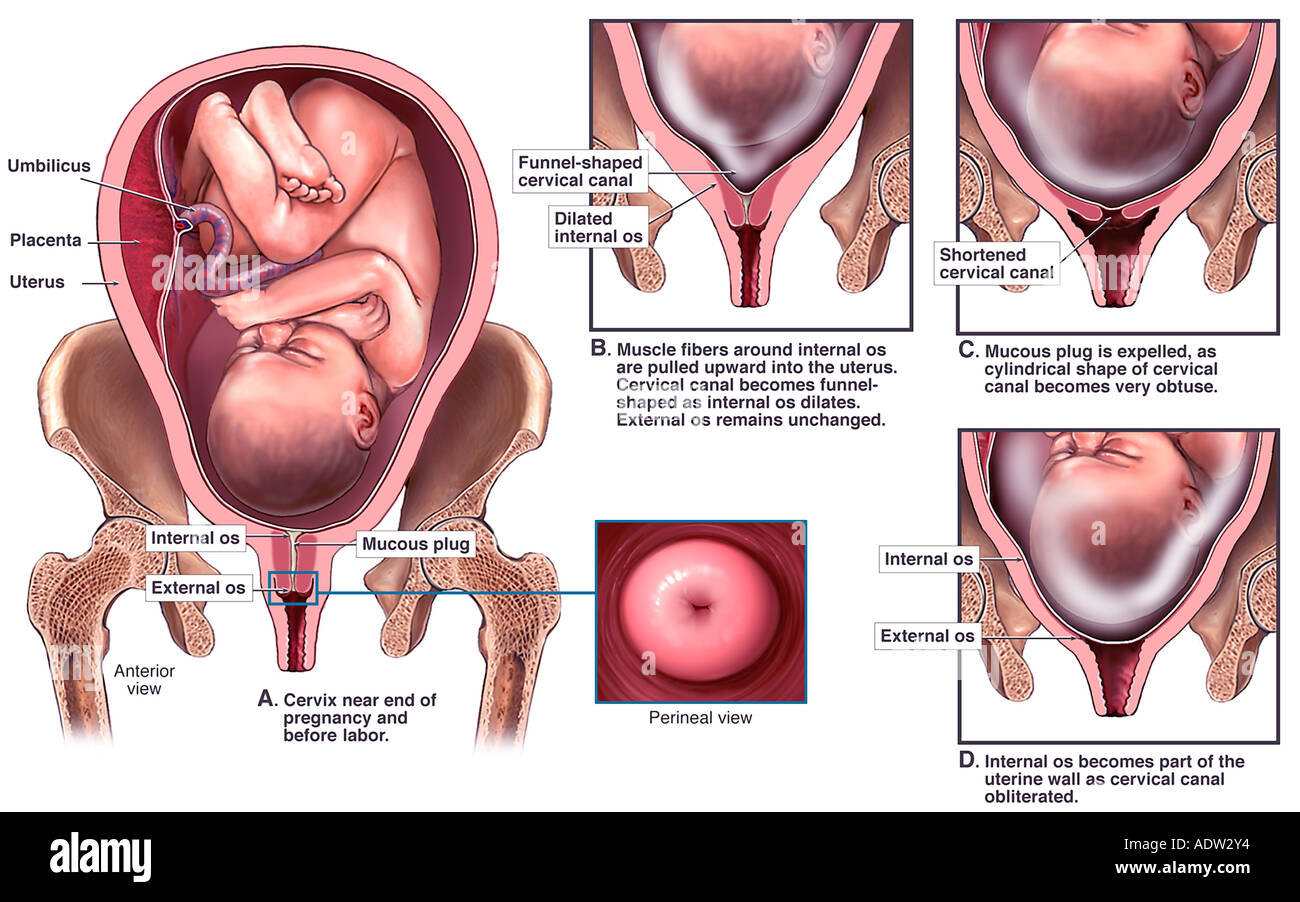 Cervix Labor Stock Photos & Cervix Labor Stock Images - Alamy Cervix Labor Stock Photos & Cervix Labor Stock Images - Alamy