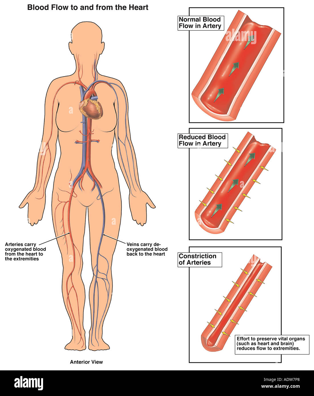 Circulatory collapse hi-res stock photography and images - Alamy