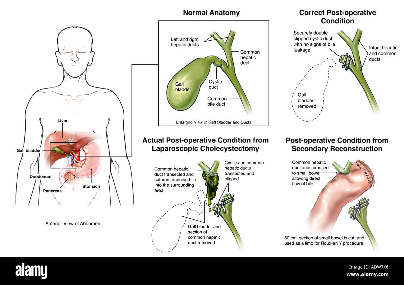 Gallbladder Cystic Duct Anatomy