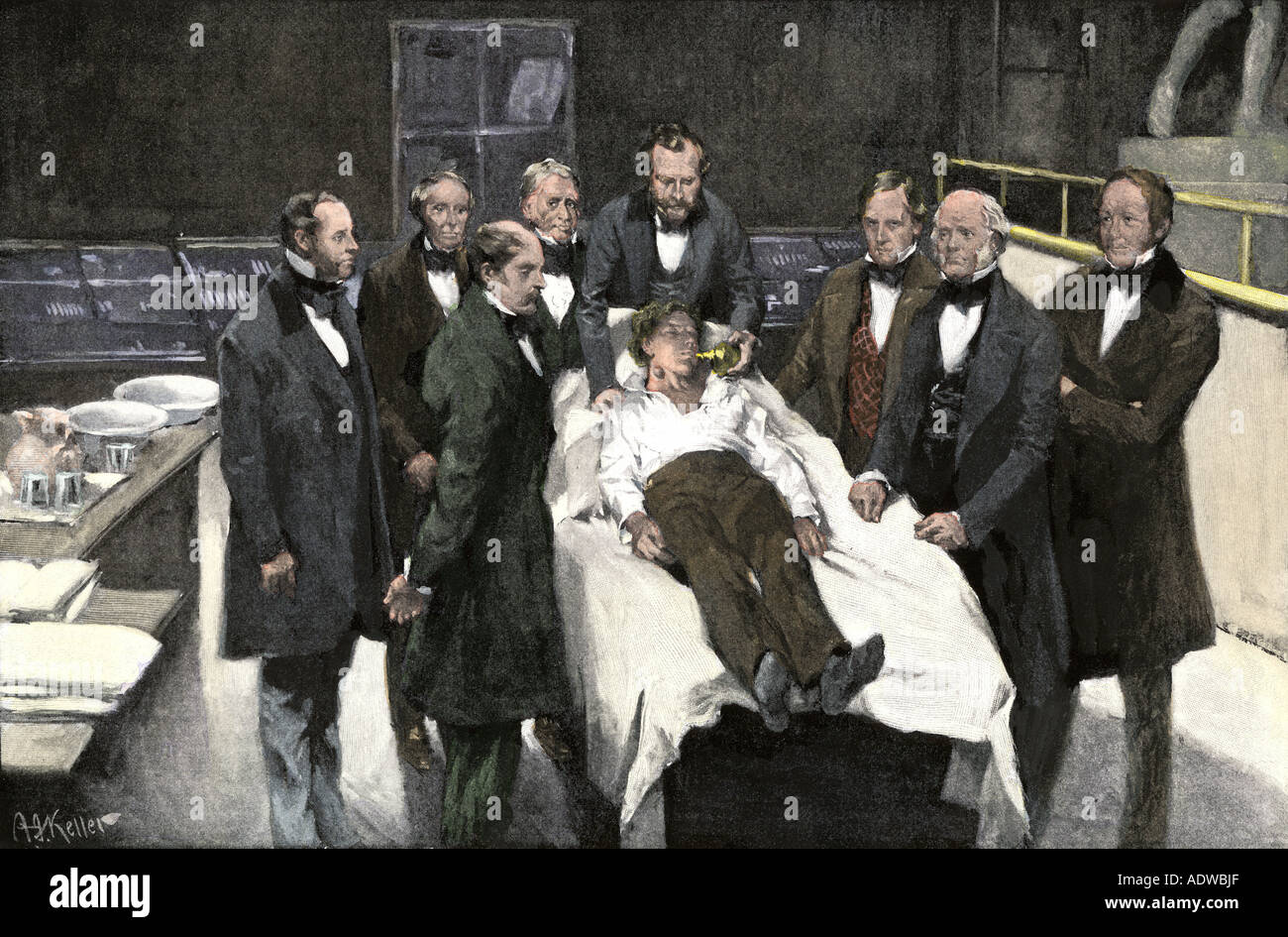 First public use of surgical anesthesia at Massachusetts General Hospital Boston 1846. Hand-colored halftone of a photograph Stock Photo