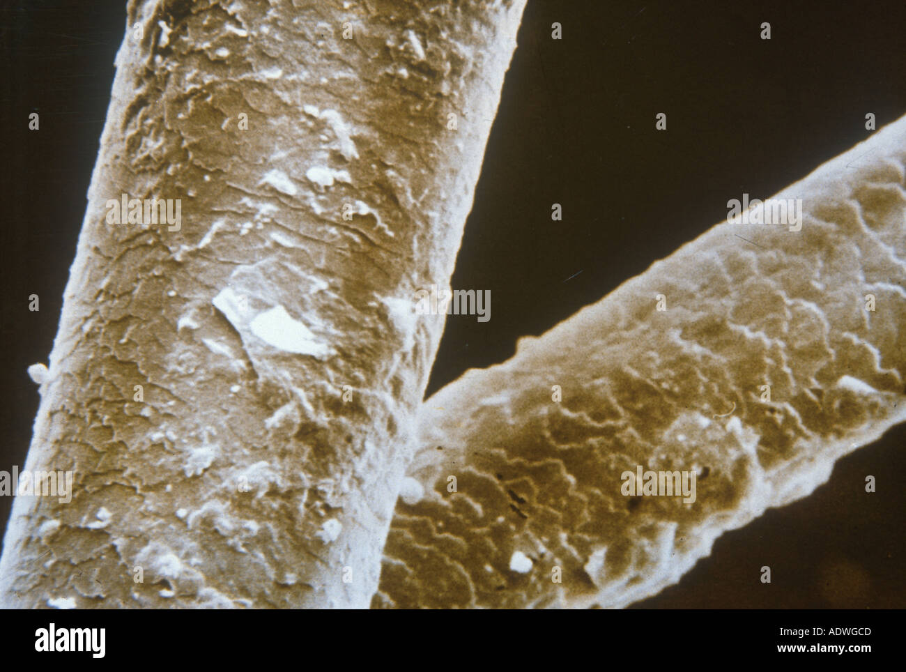 Keratin micrograph hires stock photography and images Alamy
