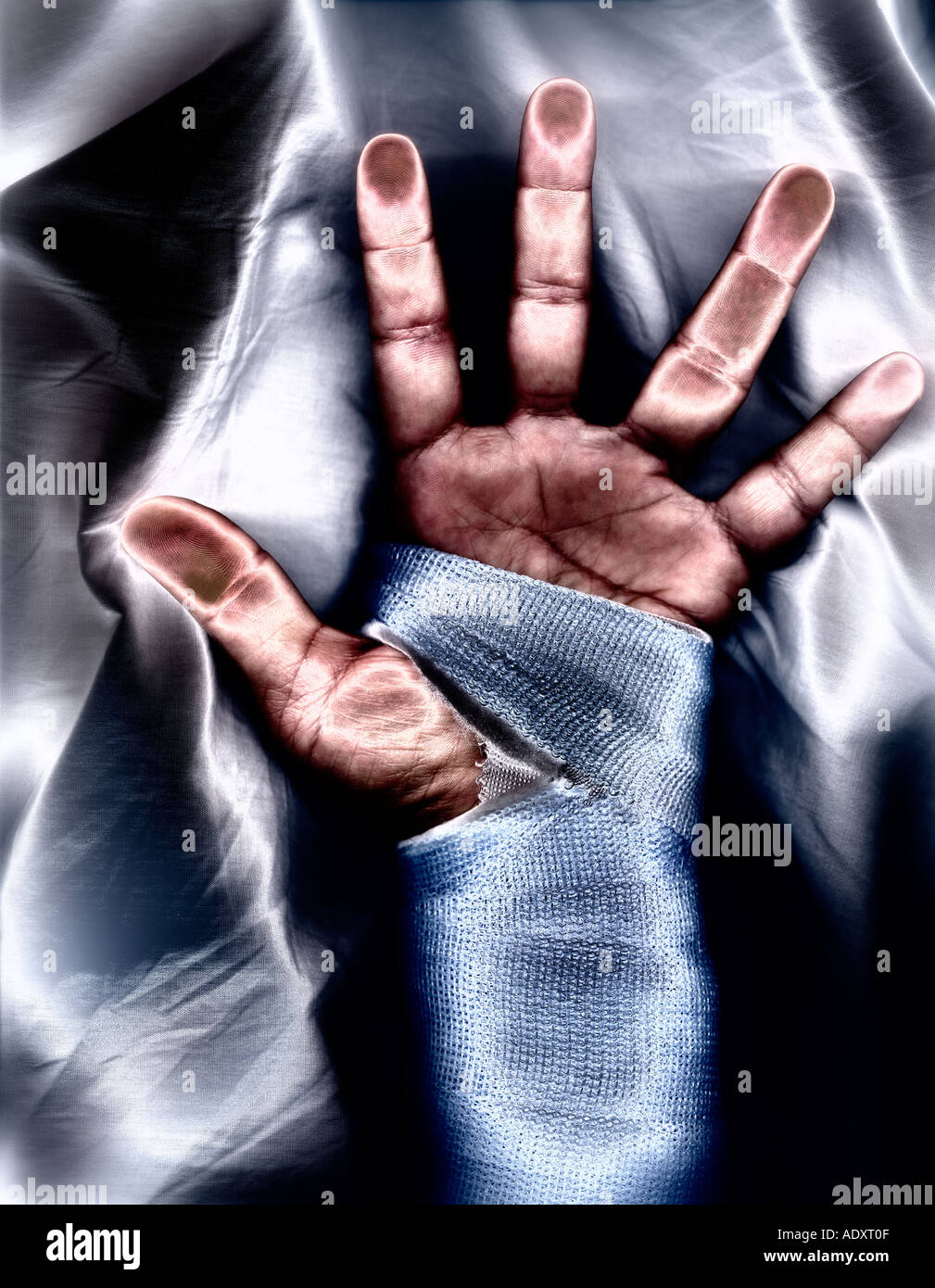 Fiberglass cast hires stock photography and images Alamy