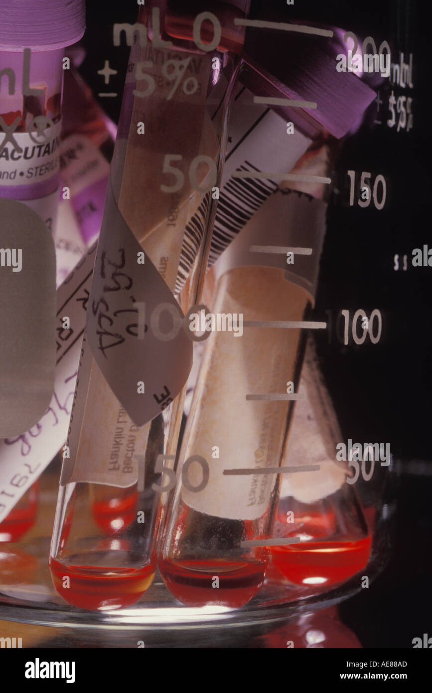 Blood in test tubes Stock Photo Alamy