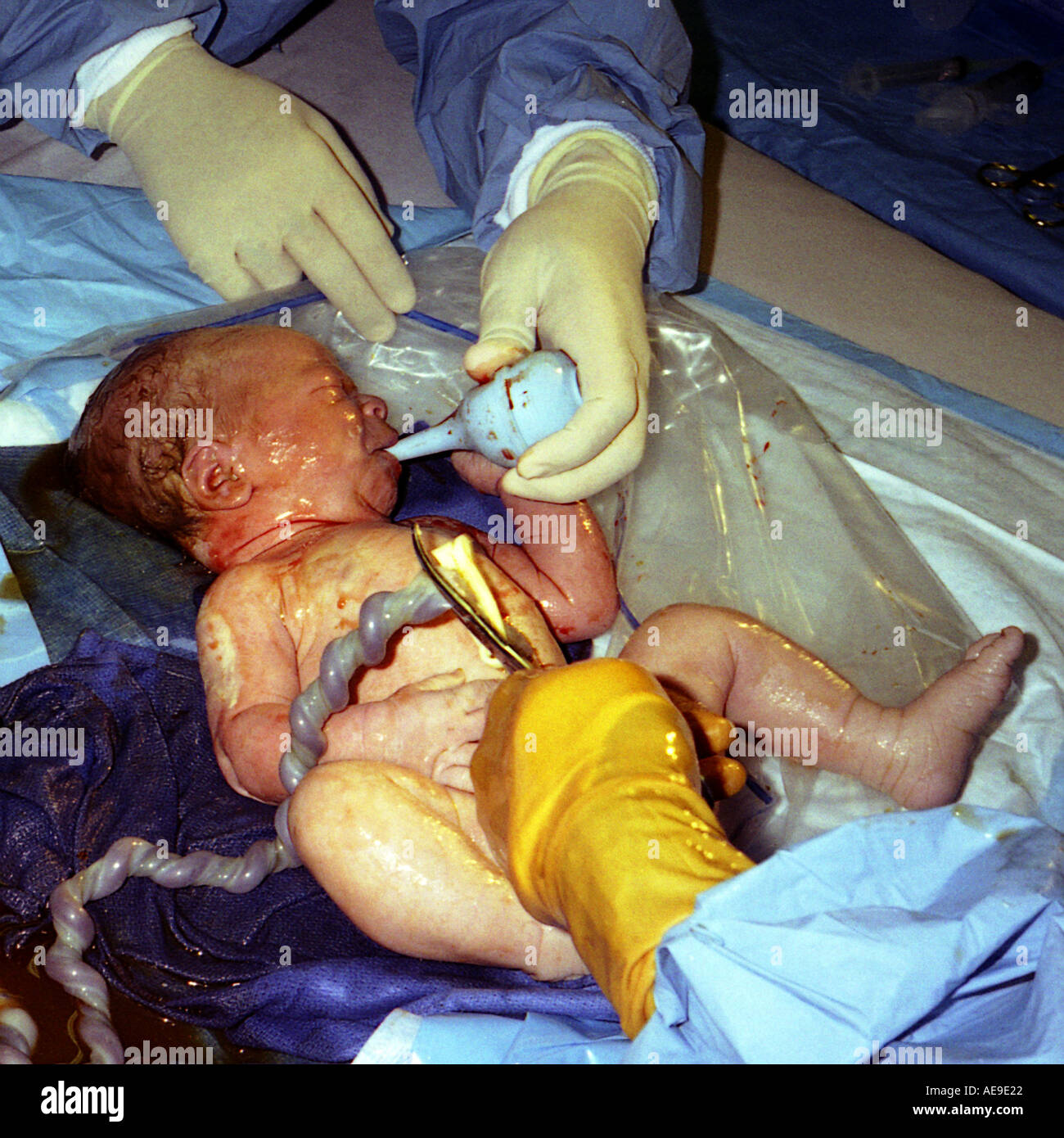 Baby Just Born In Delivery Room Still Attached Via Umbilical Cord Stock Photo Alamy