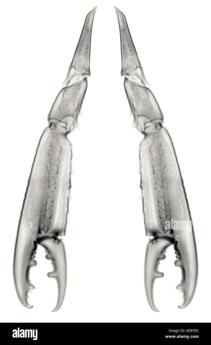 X-ray photograph of langoustine claws (Nephrops norvegicus).  Radiographie de pinces de langoustine (Nephrops norvegicus). Stock Photo