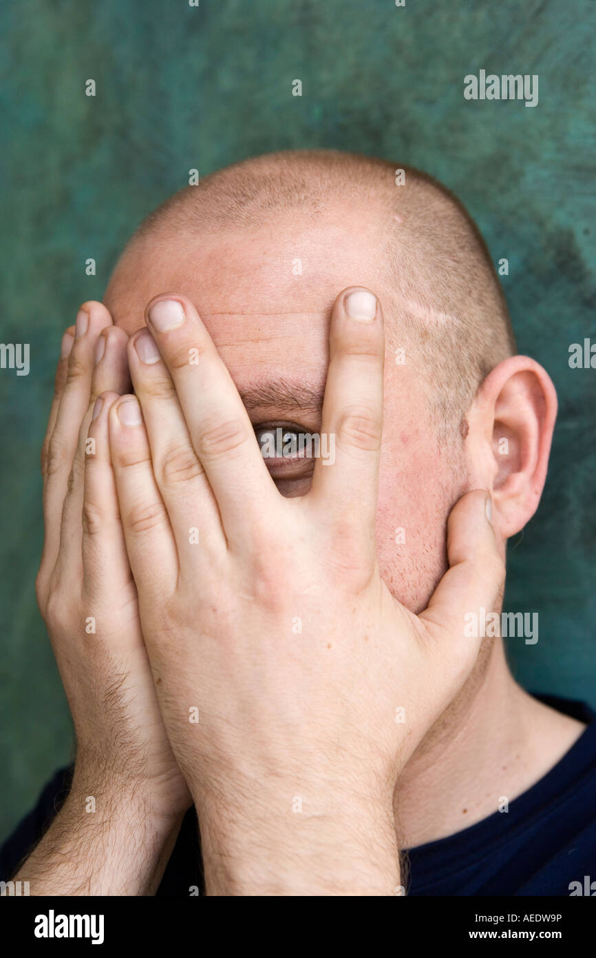 Man Covering Face With Hands Stock Photo