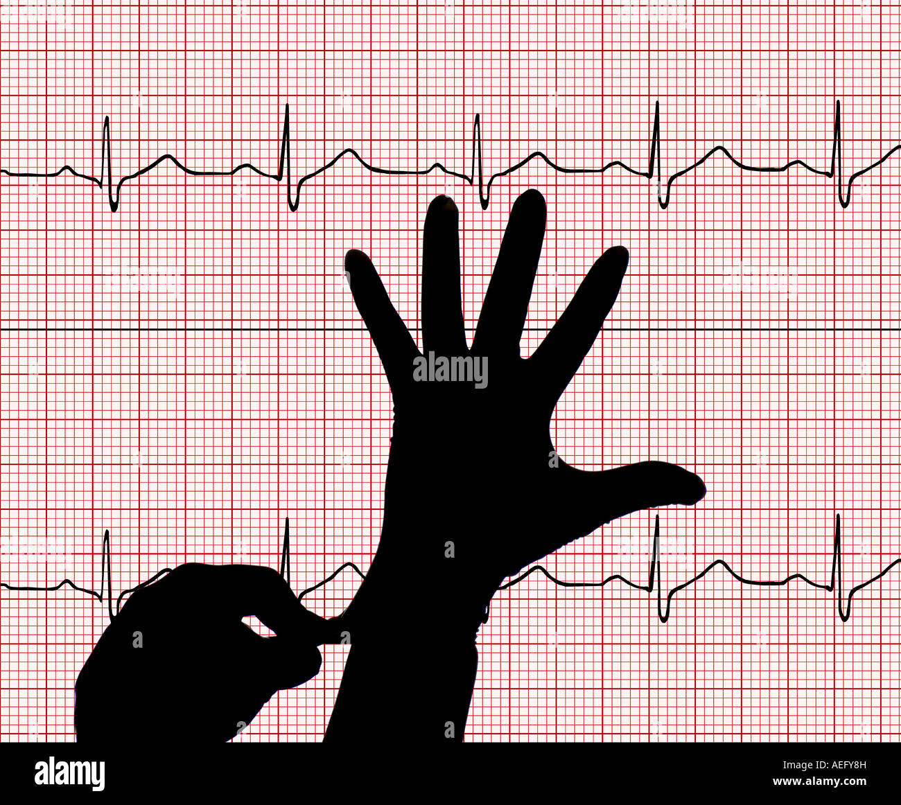 surgeon putting on surgical gloves composited on an EKG printout Stock Photo