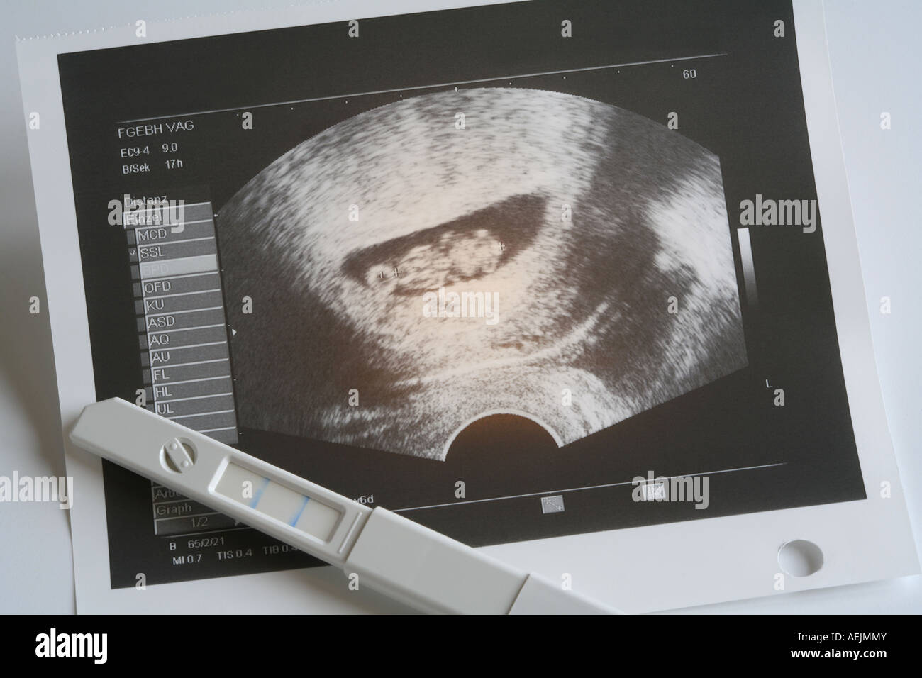 Schwangerschaftstest pregnancy test hi-res stock photography and images -  Alamy