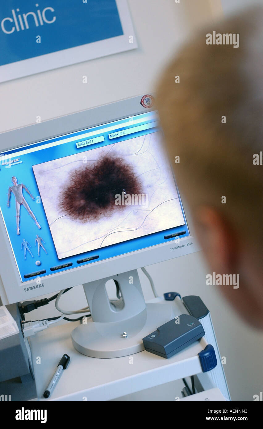 The Mole Clinic, London, uk Stock Photo Alamy