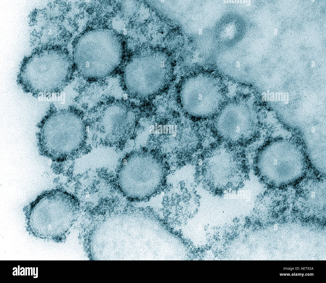 transmission electron microscope image of the human AIDS virus HIV 1 Stock Photo