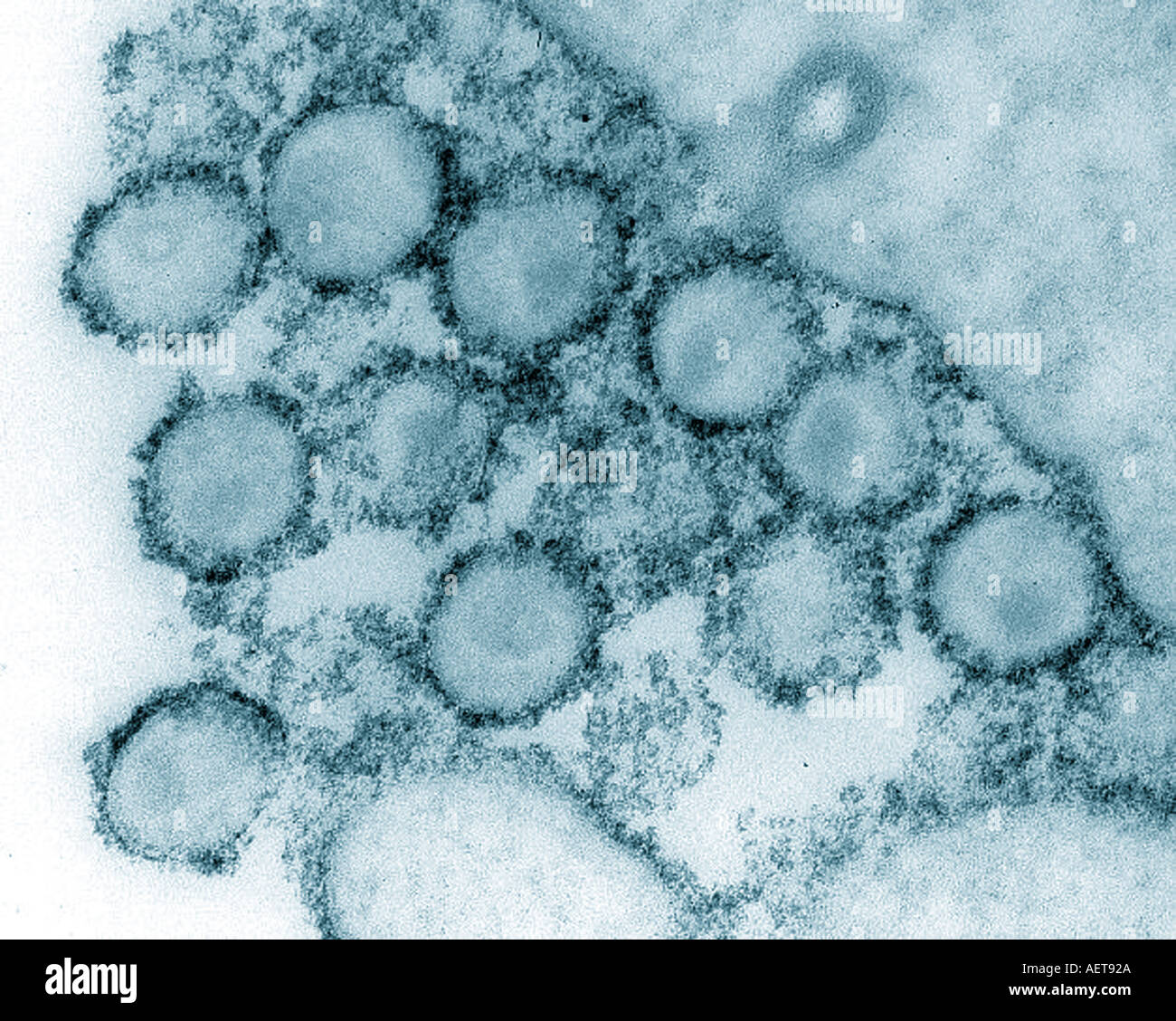 What Does Aids Virus Look Like At Gary Cathey Blog