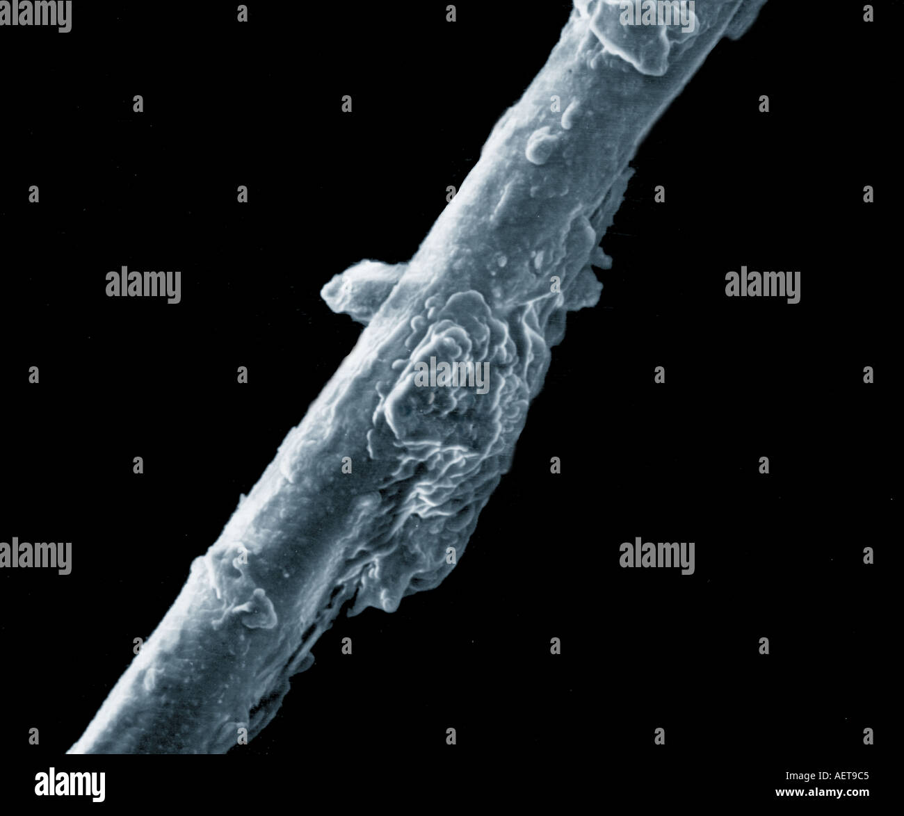 Microscopic Images Of Eyelashes