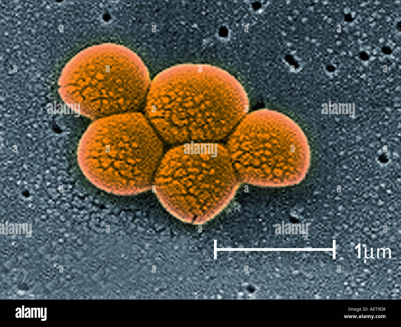 1937 Medical Bacteria Strep Staph Photo Print Microscope View