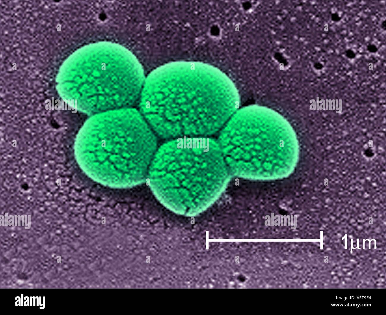 mrsa microscope