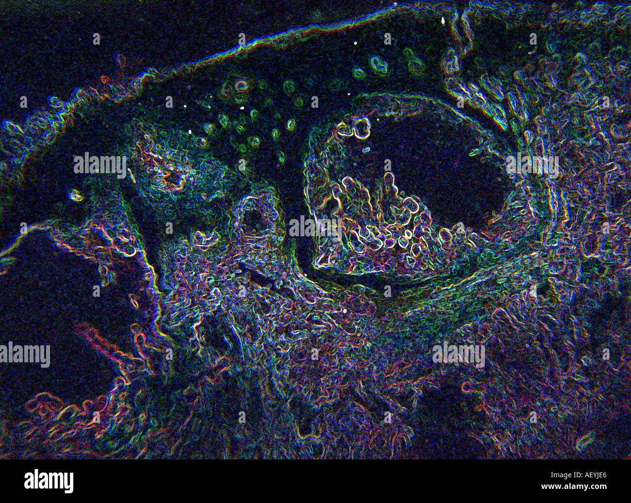 Virus, extreme closeup micro photography Stock Photo