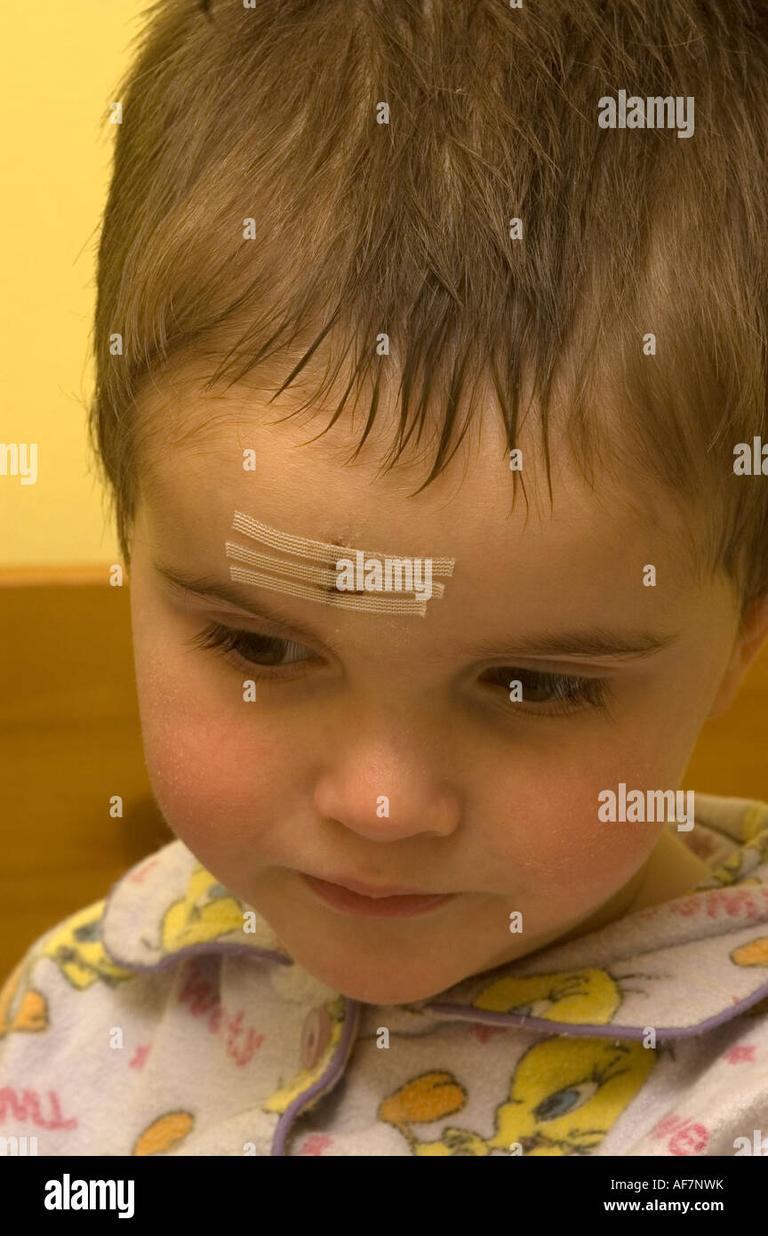 Little Boy With Butterfly Stitches In His Forehead Stock Photo