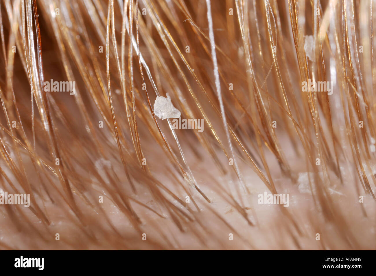 human hair up close