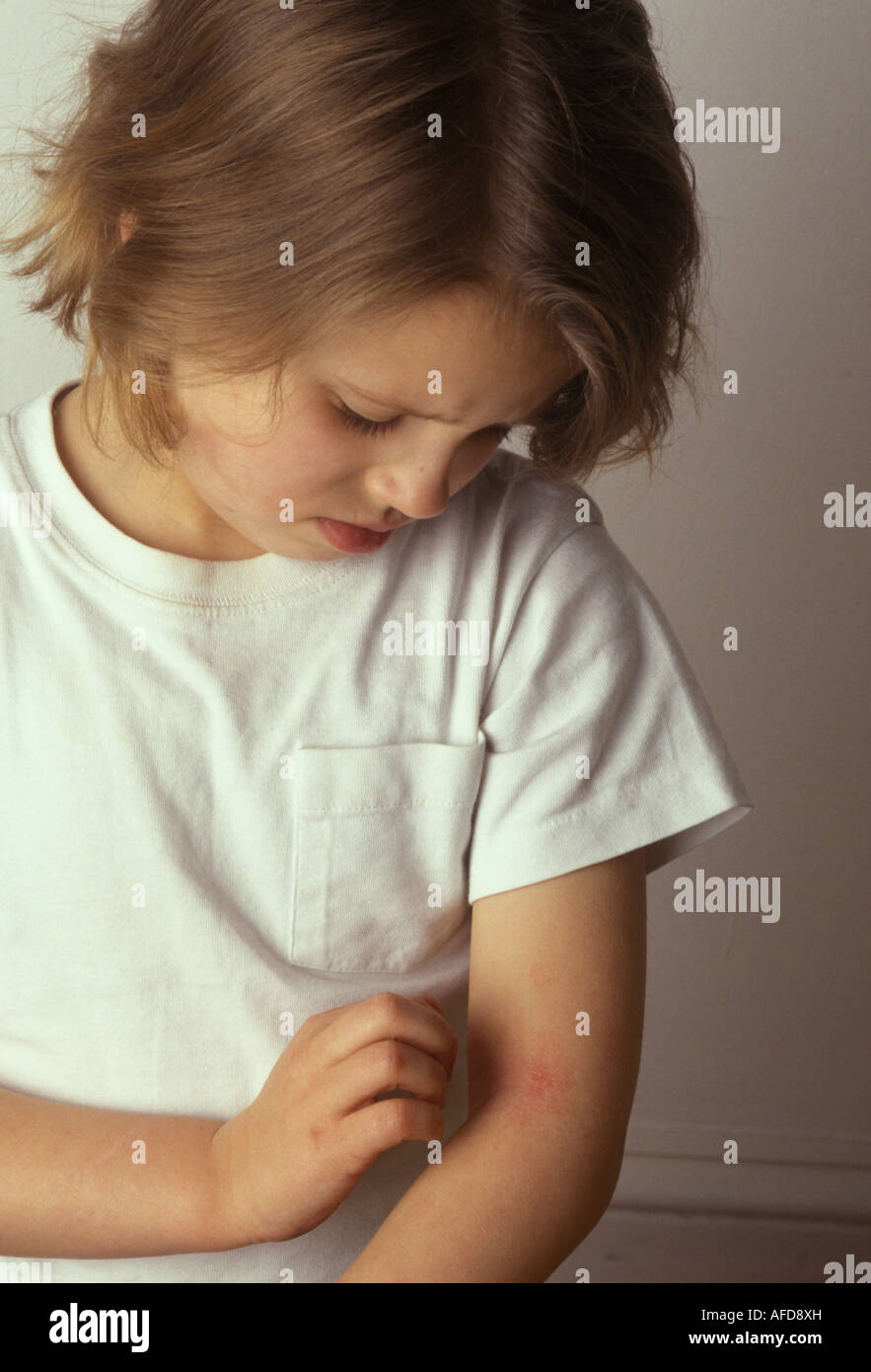 child scratching her eczema in the fold of her elbow Stock Photo