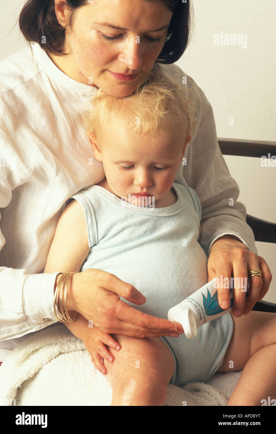 mother putting cream onto her child s eczema Stock Photo Alamy