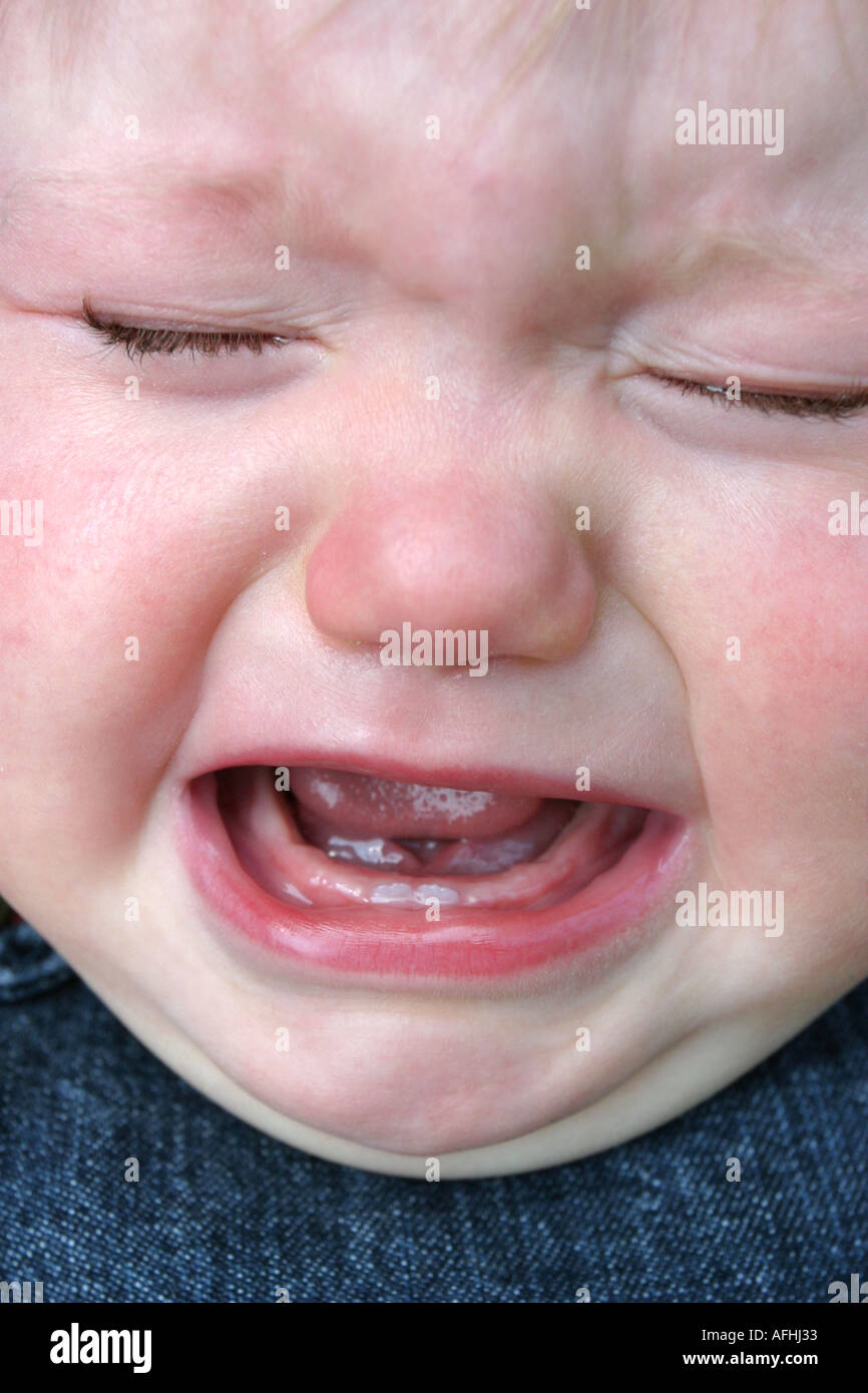 Teething Pain Stock Photo Alamy