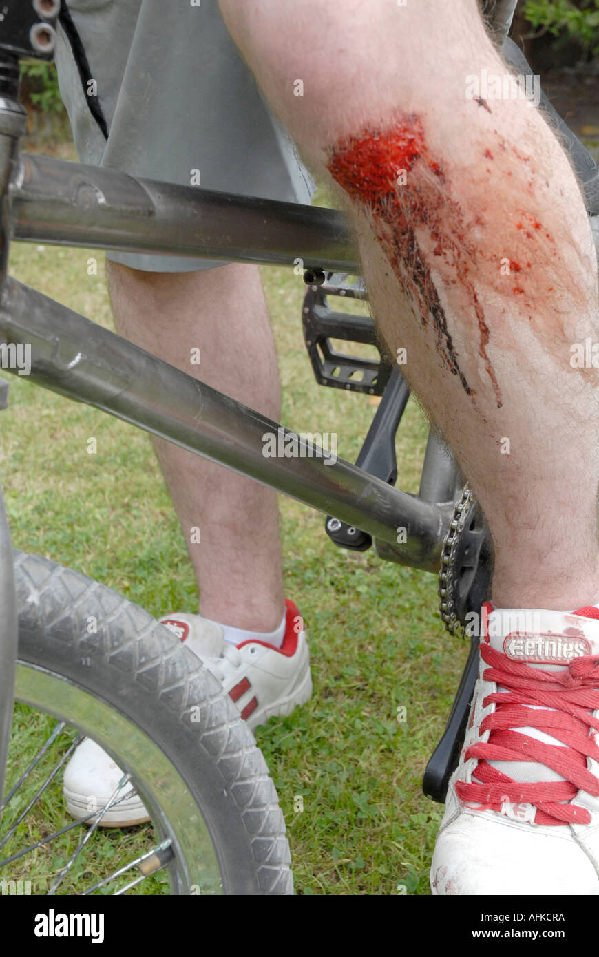 Bmx injury hi-res stock photography and images - Alamy