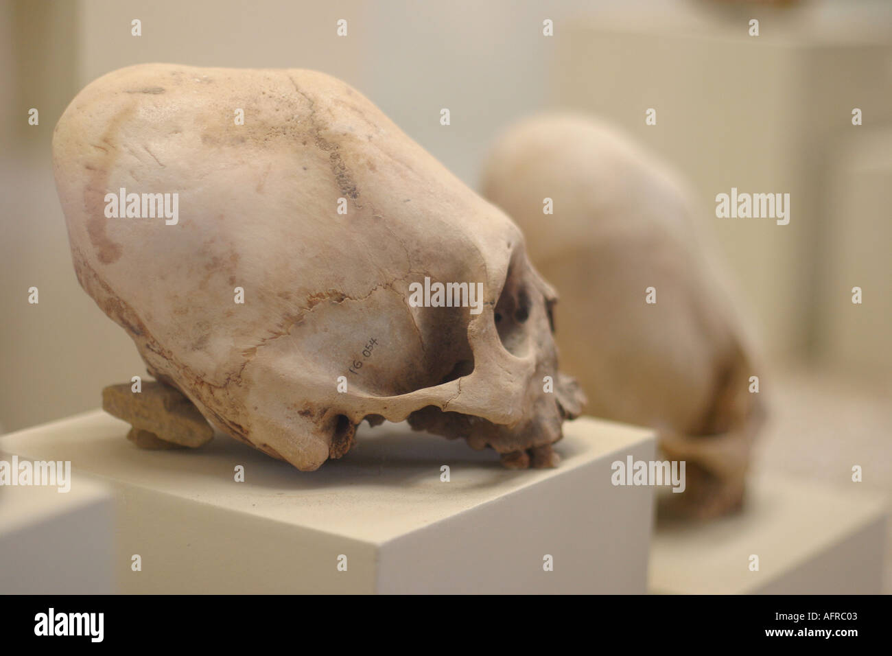 Human skull reshaped by trepaning Paraca pre Inca culture Cerro Colorado museum Peru Stock Photo