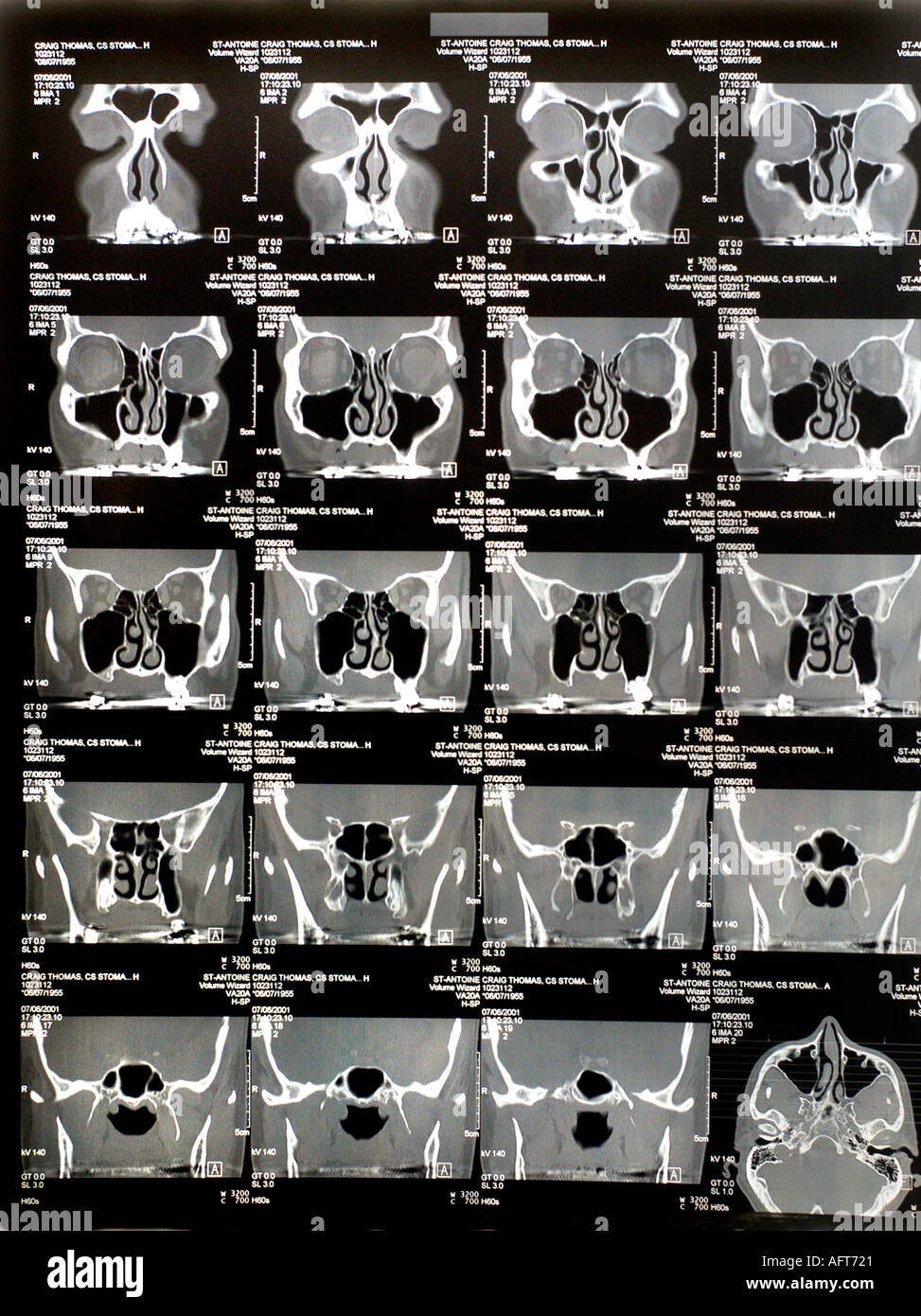 Medical Technology Diagnosis CT Scan X Rays of head, Health Care Stock Photo Alamy