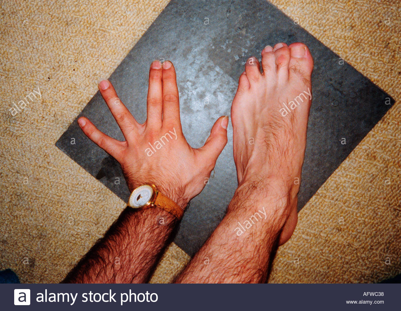 webbed feet human webbed feet human