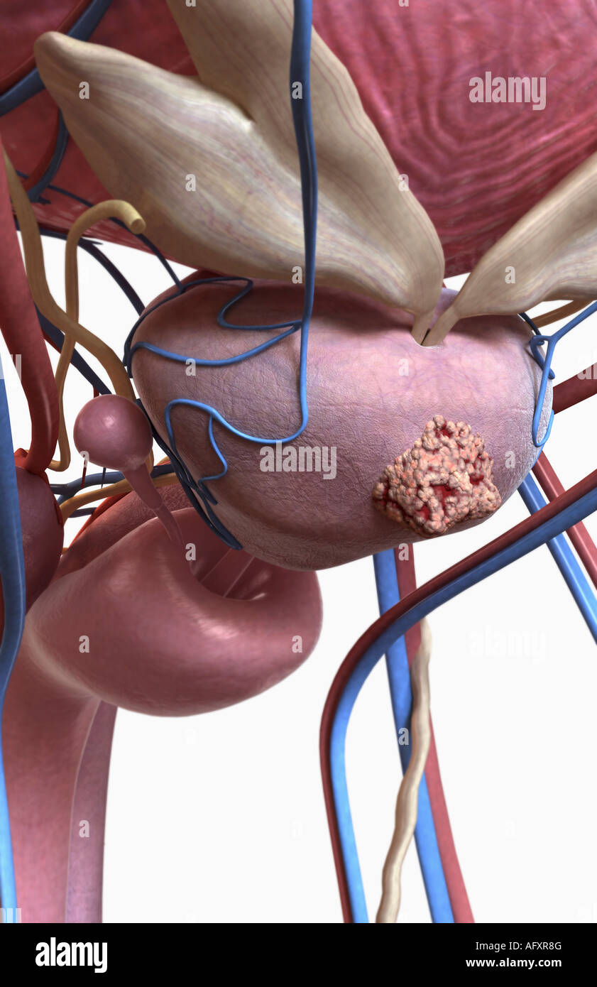 Протонная терапия дозное распределение. Протонная терапия предстательной железы. Узи предстательной железы. Протонная терапия предстательной железы. Узи предстательной железы.