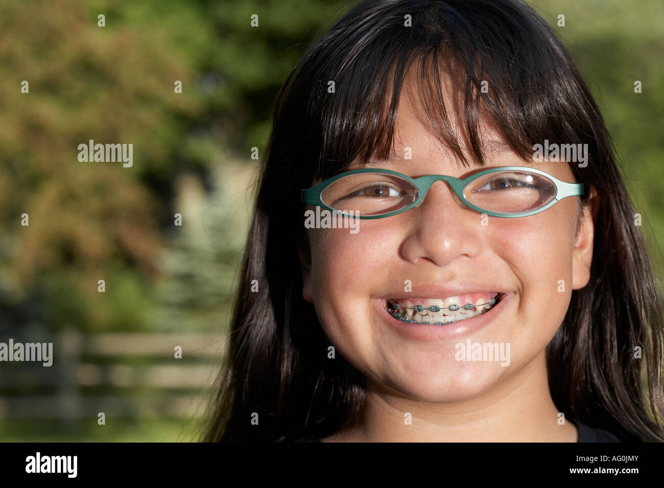 Big Smile With Braces Hi Res Stock Photography And Images Alamy
