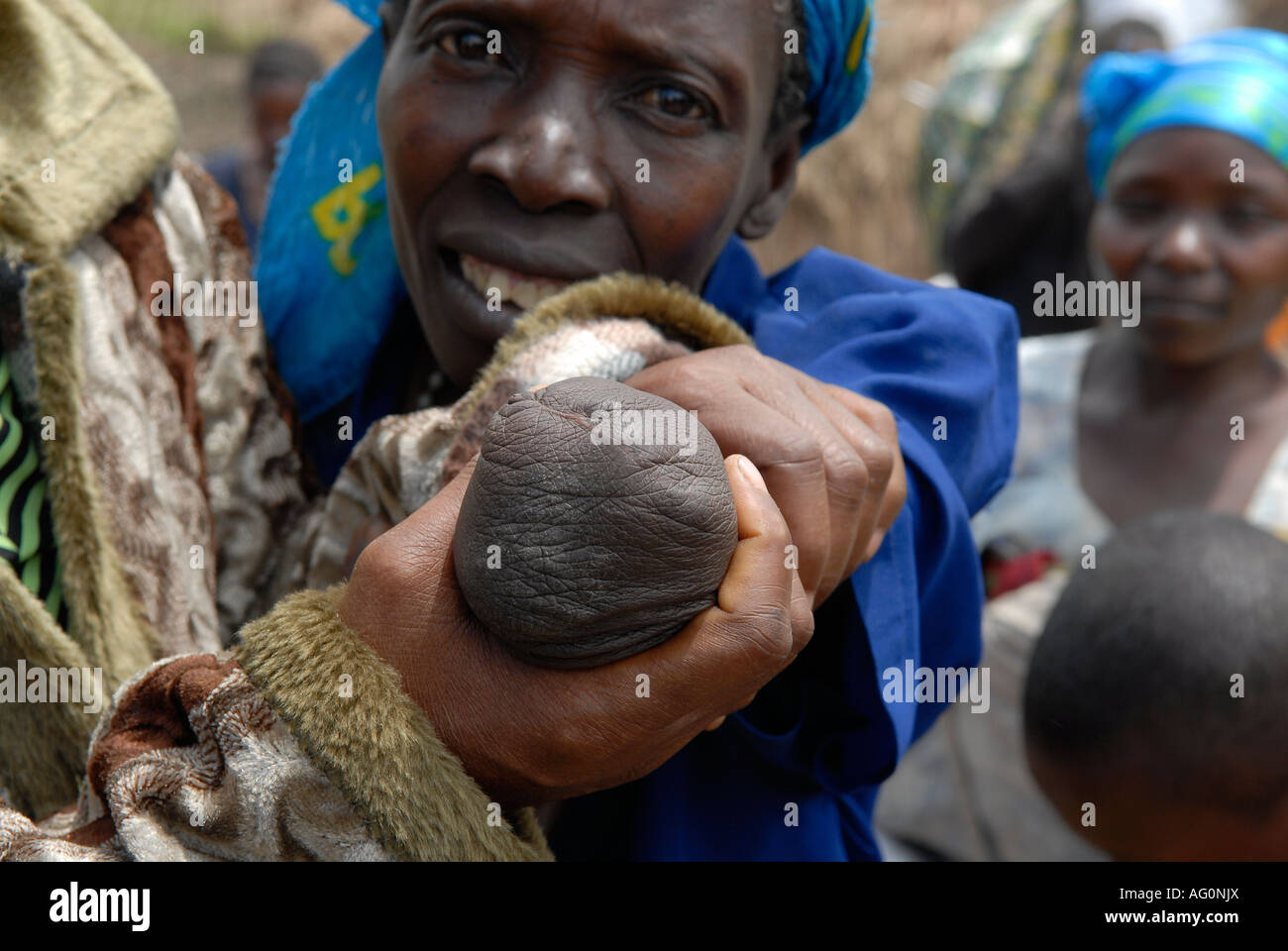 An Internally displaced woman shows her arm cut off by rebel militia fighters in an IDP camp in North Kivu province DR Congo Africa Stock Photo