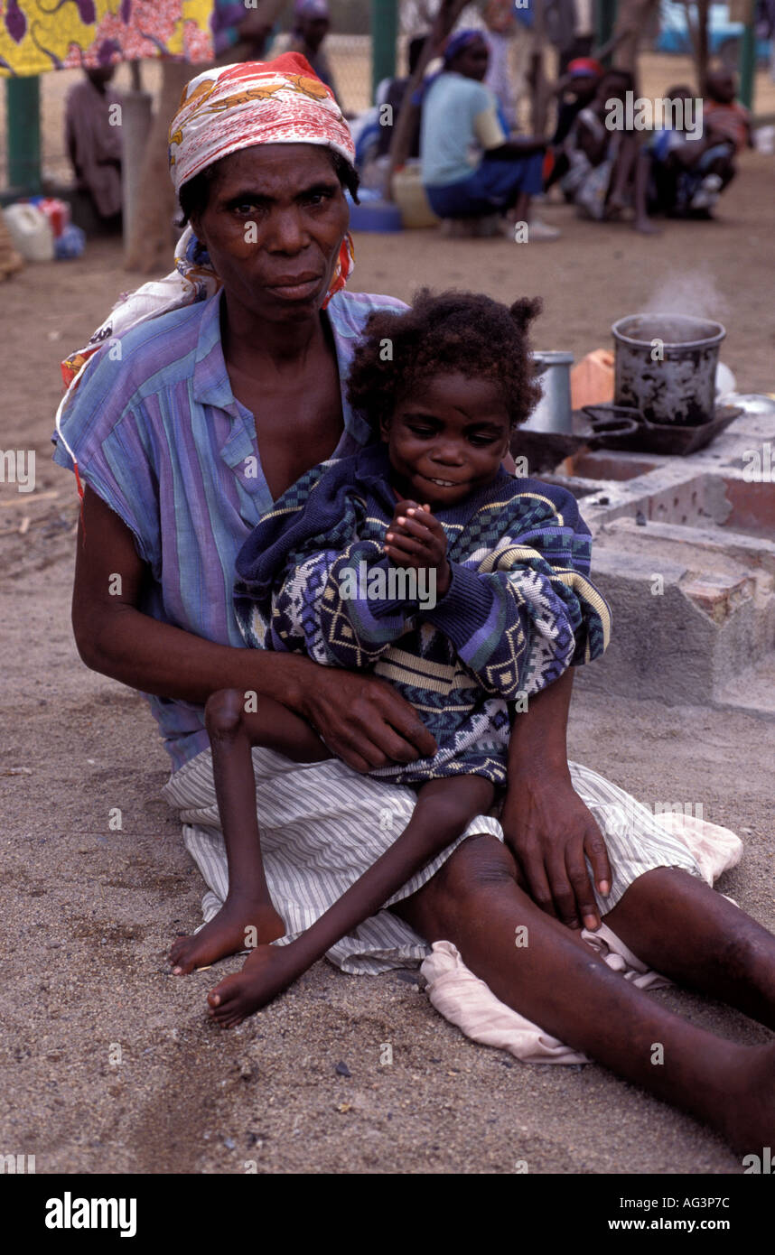 Angola. Polio victim (7 year old girl) in Benguela Province Stock Photo