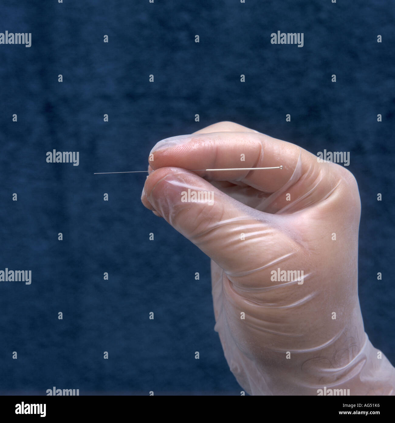 Hand with a acupuncture needle Stock Photo Alamy