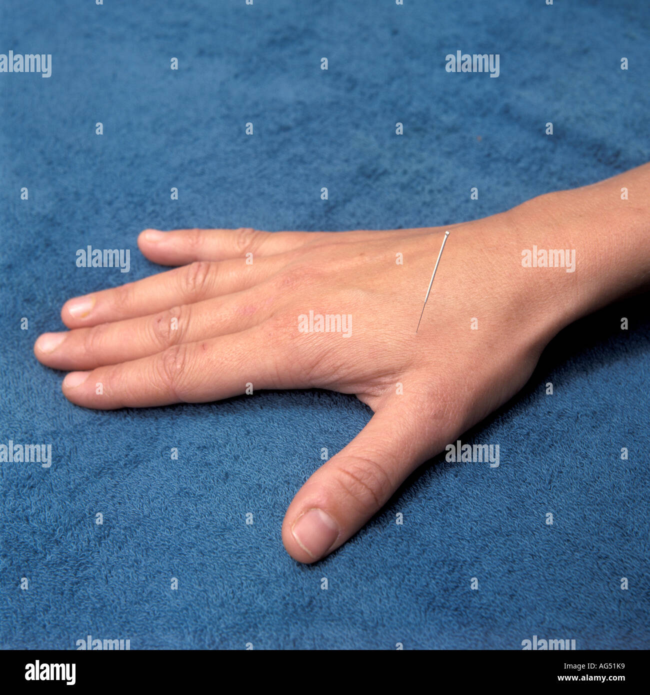 Hand with a acupuncture needle Stock Photo Alamy