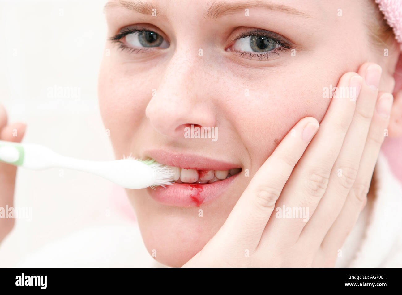Bleeding gum hires stock photography and images Alamy
