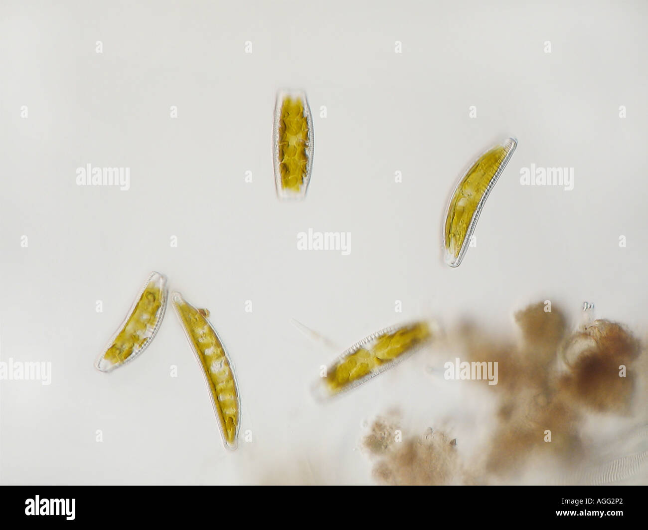 Epithemia spec. (Epithemia spec.), different individuals in shining