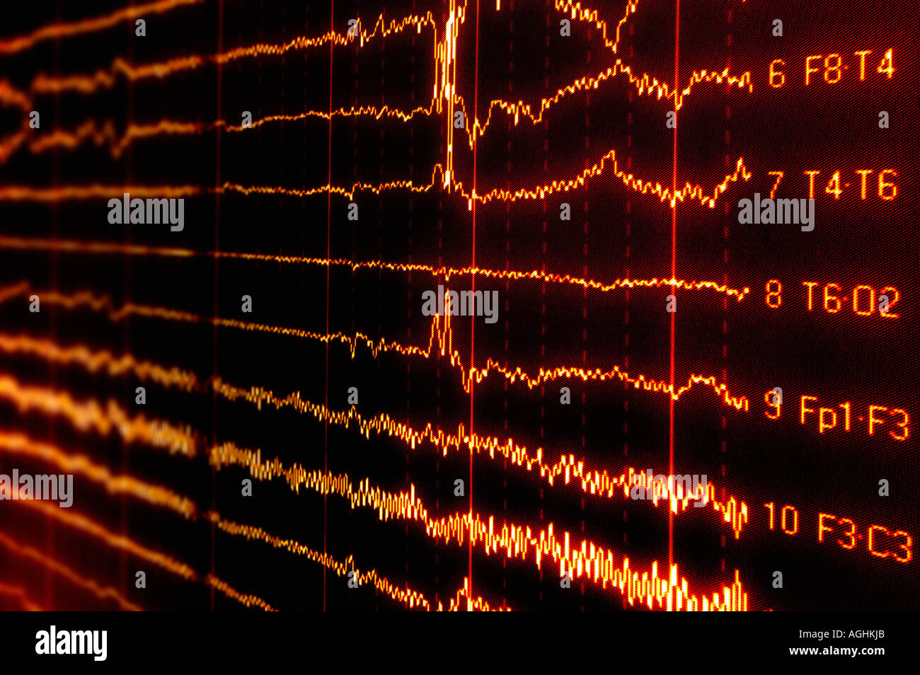 brain waves (alfa, beta, gamma) showing higher mental activity, including perception and consciousness Stock Photo