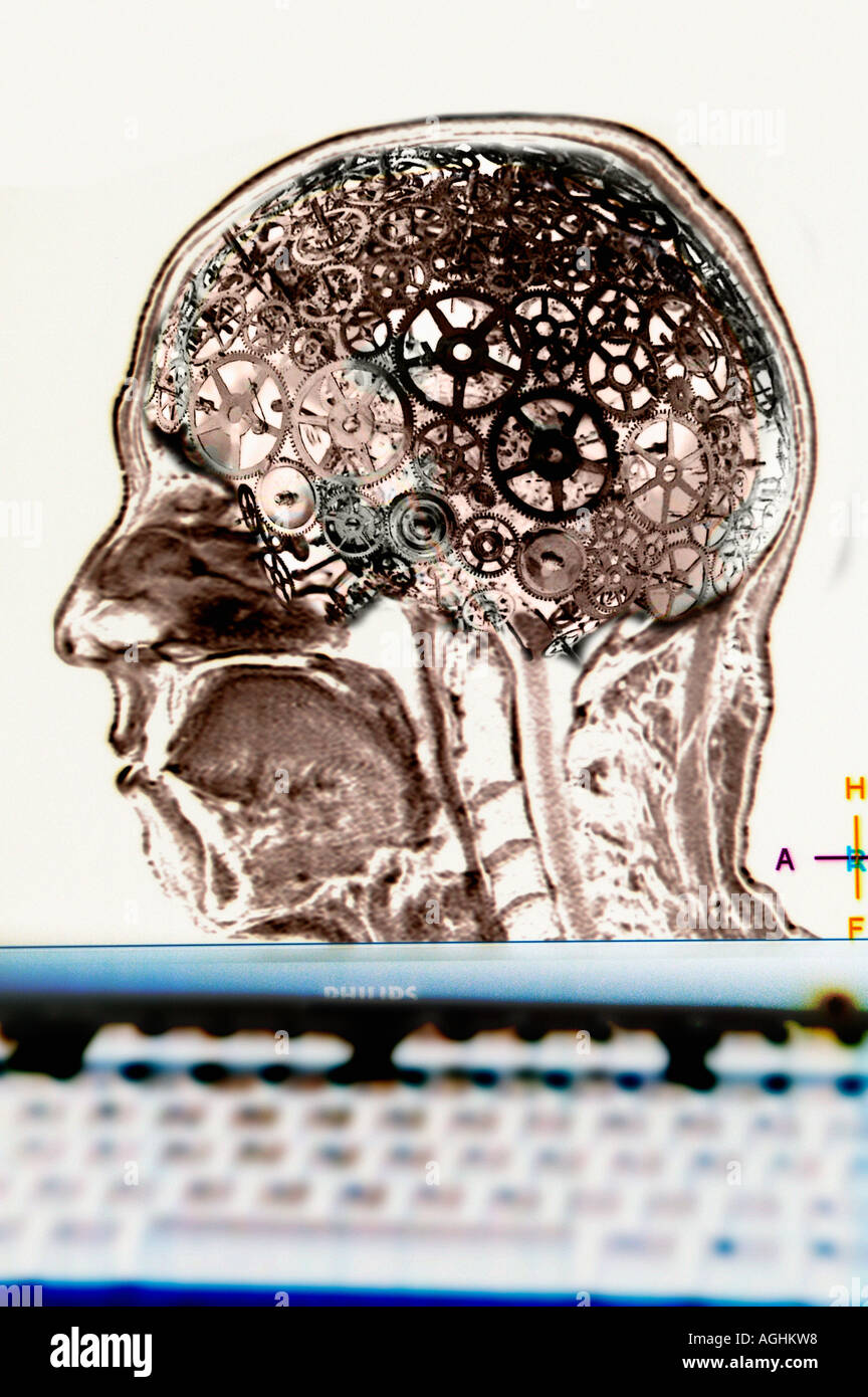symbolic image of the human brain as a complex machinery Stock Photo
