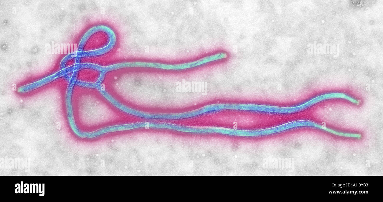Ebola virus transmission electron micrograph image colorized Original image from CDC Stock Photo