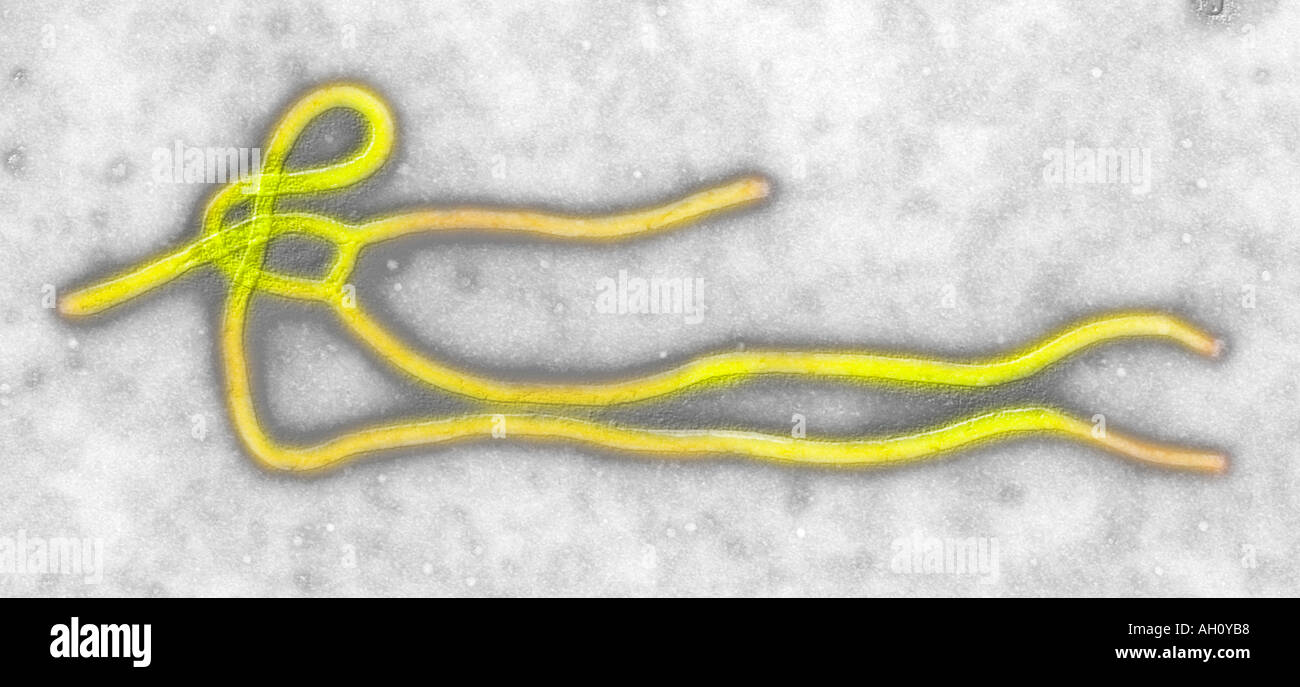 Ebola virus transmission electron micrograph image colorized Original image from CDC Stock Photo
