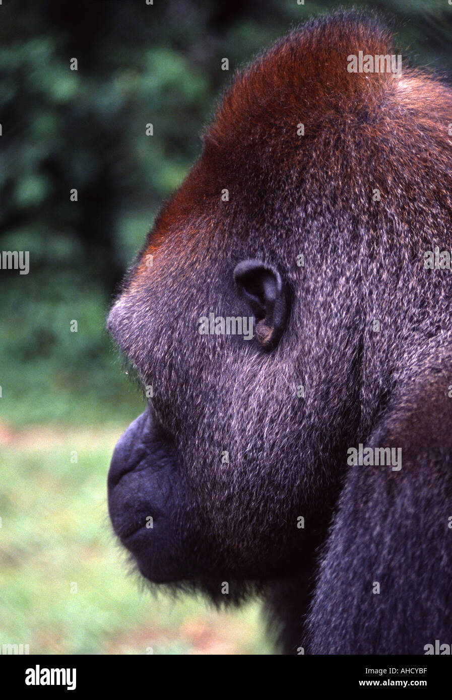 Pronounced Coronal Ridge