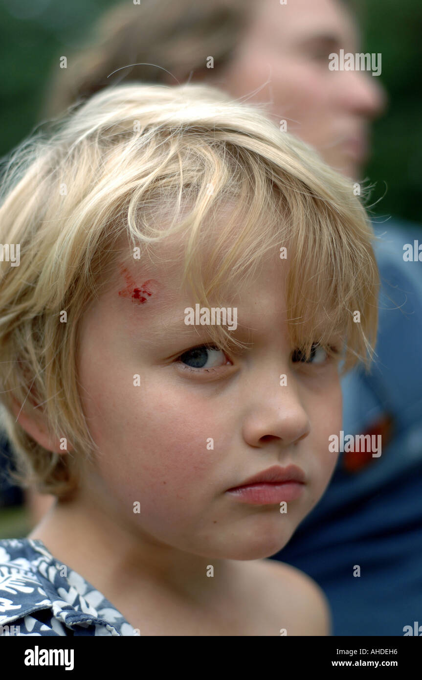 Child head injury sport hi-res stock photography and images - Alamy