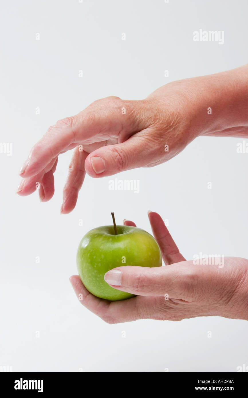 WOMAN'S HANDS WITH RHEUMATOID ARTHRITIS HOLDING GREEN APPLE Stock Photo